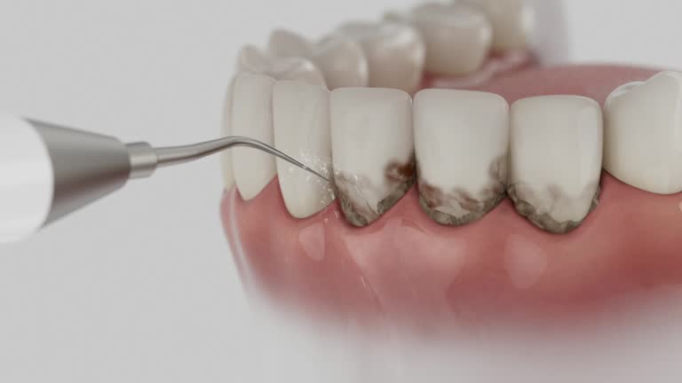 Trusted Wisdom Tooth Removal service in Thermalito, CA - Dentist Open Now